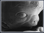 Is it really that dark in the womb? Development of fetus vision.